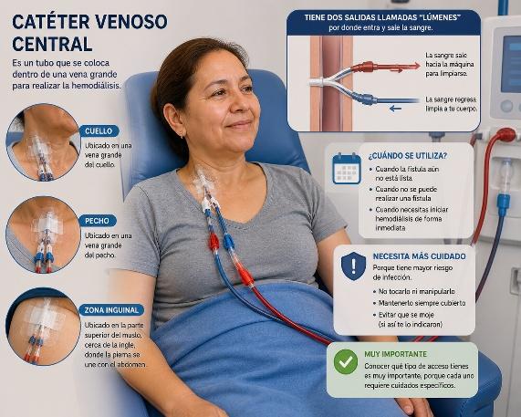Catéter venoso central