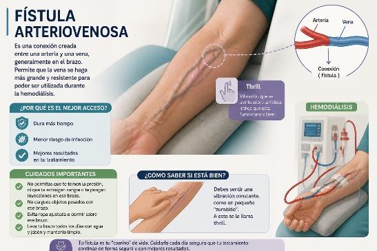 Fístula arteriovenosa en el brazo
